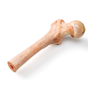 Proximal Femur with Head, Irradiated, Frozen