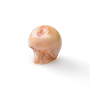 Femoral Head Whole, Irradiated, Frozen