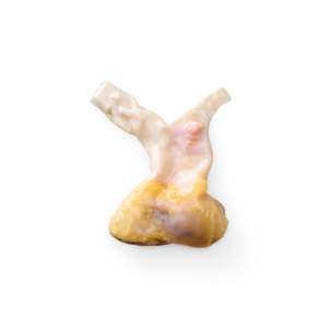 Pulmonary Valve and Conduit, 30mm