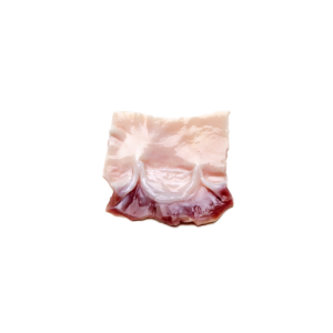 Pièce pulmonaire, mono cuspide