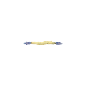 Pediatric Conduit, Saphenous Vein Competent Valve