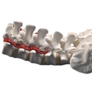 Demineralized Bone Fibers Strip, 25x50x4mm