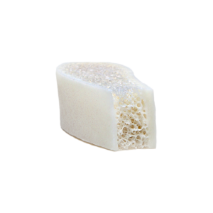 Tricortical Iliac Crest Wedge, Freeze-Dried, 9mm