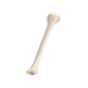 Left Proximal Tibia with Patella, Aseptic, Frozen