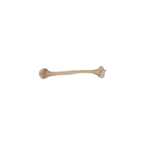 Left Proximal Humerus without Cuff, Aseptic, Frozen