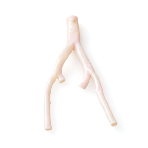 Aortoiliac Junctions