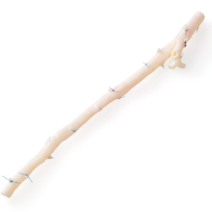 Common Femoral Artery
