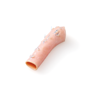 Thoracic Aorta