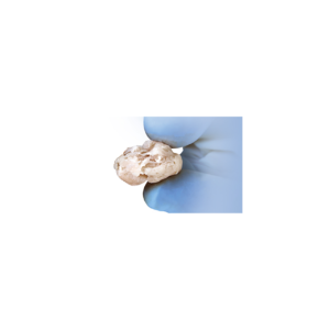 Viable Cartilage Matrix, Frozen
