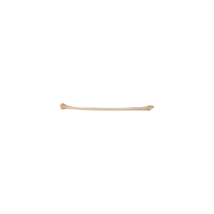 Left Proximal Fibula, Aseptic, Frozen