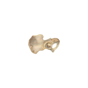 Third of Hemi-Pelvis, Aseptic, Frozen